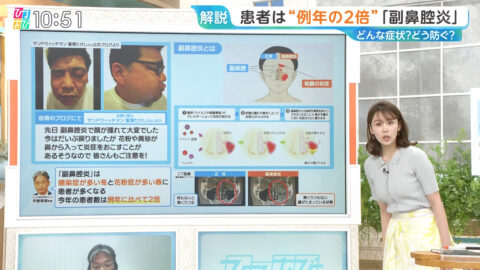 良原安美_ひるおび_20250428_004
